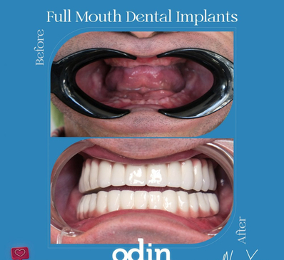 Slider image (6) Odin Clinic